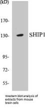 SHIP1 Colorimetric Cell-Based ELISA Kit