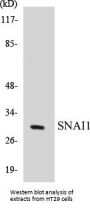 SNAI1 Colorimetric Cell-Based ELISA Kit
