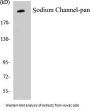 Sodium Channel-pan Colorimetric Cell-Based ELISA Kit