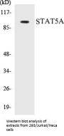 STAT5A Colorimetric Cell-Based ELISA Kit