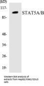 STAT5A/B Colorimetric Cell-Based ELISA Kit