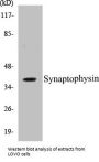 Synaptophysin Colorimetric Cell-Based ELISA Kit