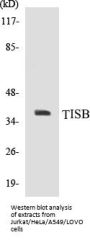 TISB Colorimetric Cell-Based ELISA Kit