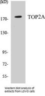 TOP2A Colorimetric Cell-Based ELISA Kit