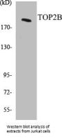 TOP2B Colorimetric Cell-Based ELISA Kit