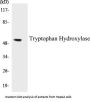 Tryptophan Hydroxylase Colorimetric Cell-Based ELISA Kit