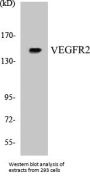 VEGFR2 Colorimetric Cell-Based ELISA Kit