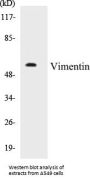 Vimentin Colorimetric Cell-Based ELISA Kit