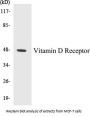 Vitamin D Receptor Colorimetric Cell-Based ELISA Kit