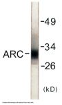 ARC Colorimetric Cell-Based ELISA