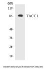 TACC1 Colorimetric Cell-Based ELISA