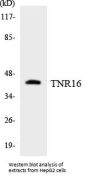 TNR16 Colorimetric Cell-Based ELISA