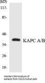 KAPC A/B Colorimetric Cell-Based ELISA