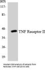TNF Receptor II Colorimetric Cell-Based ELISA