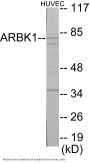 ARBK1 Colorimetric Cell-Based ELISA