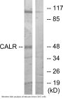 CALR Colorimetric Cell-Based ELISA