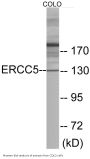 ERCC5 Colorimetric Cell-Based ELISA