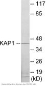 KAP1 Colorimetric Cell-Based ELISA