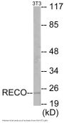 Recoverin Colorimetric Cell-Based ELISA