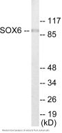 SOX6 Colorimetric Cell-Based ELISA
