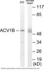 ACV1B Colorimetric Cell-Based ELISA
