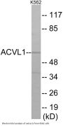 ACVL1 Colorimetric Cell-Based ELISA