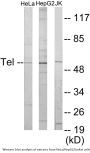 ETV6 Colorimetric Cell-Based ELISA