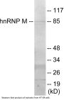 hnRNP M Colorimetric Cell-Based ELISA