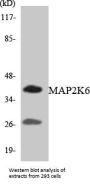 MAP2K6 Colorimetric Cell-Based ELISA