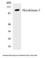 Hexokinase-3 Colorimetric Cell-Based ELISA