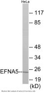 EFNA5 Colorimetric Cell-Based ELISA