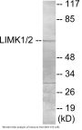 LIMK1 Colorimetric Cell-Based ELISA