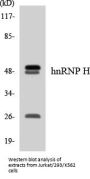 hnRNP H Colorimetric Cell-Based ELISA