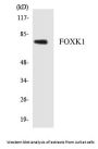 FOXK1 Colorimetric Cell-Based ELISA