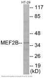 MEF2B Colorimetric Cell-Based ELISA