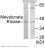 Mevalonate Kinase Colorimetric Cell-Based ELISA