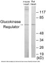 Glucokinase Regulator Colorimetric Cell-Based ELISA