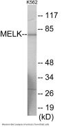 MELK Colorimetric Cell-Based ELISA