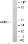 CDK10 Colorimetric Cell-Based ELISA