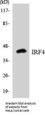 IRF4 Colorimetric Cell-Based ELISA