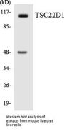 TSC22D1 Colorimetric Cell-Based ELISA