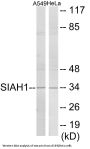 SIAH1 Colorimetric Cell-Based ELISA