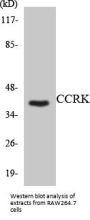 CCRK Colorimetric Cell-Based ELISA