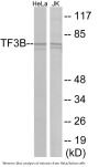 TF3B Colorimetric Cell-Based ELISA