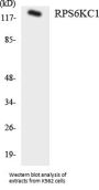 RPS6KC1 Colorimetric Cell-Based ELISA