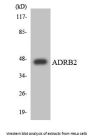 ADRB2 Colorimetric Cell-Based ELISA