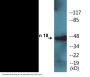 Keratin 18 (Phospho-Ser33) Colorimetric Cell-Based ELISA Kit