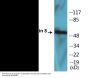 Keratin 8 (Phospho-Ser73) Colorimetric Cell-Based ELISA Kit