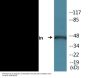 Synaptotagmin (Phospho-Thr202) Colorimetric Cell-Based ELISA Kit