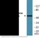 Tyrosine Hydroxylase (Phospho-Ser31) Colorimetric Cell-Based ELISA Kit